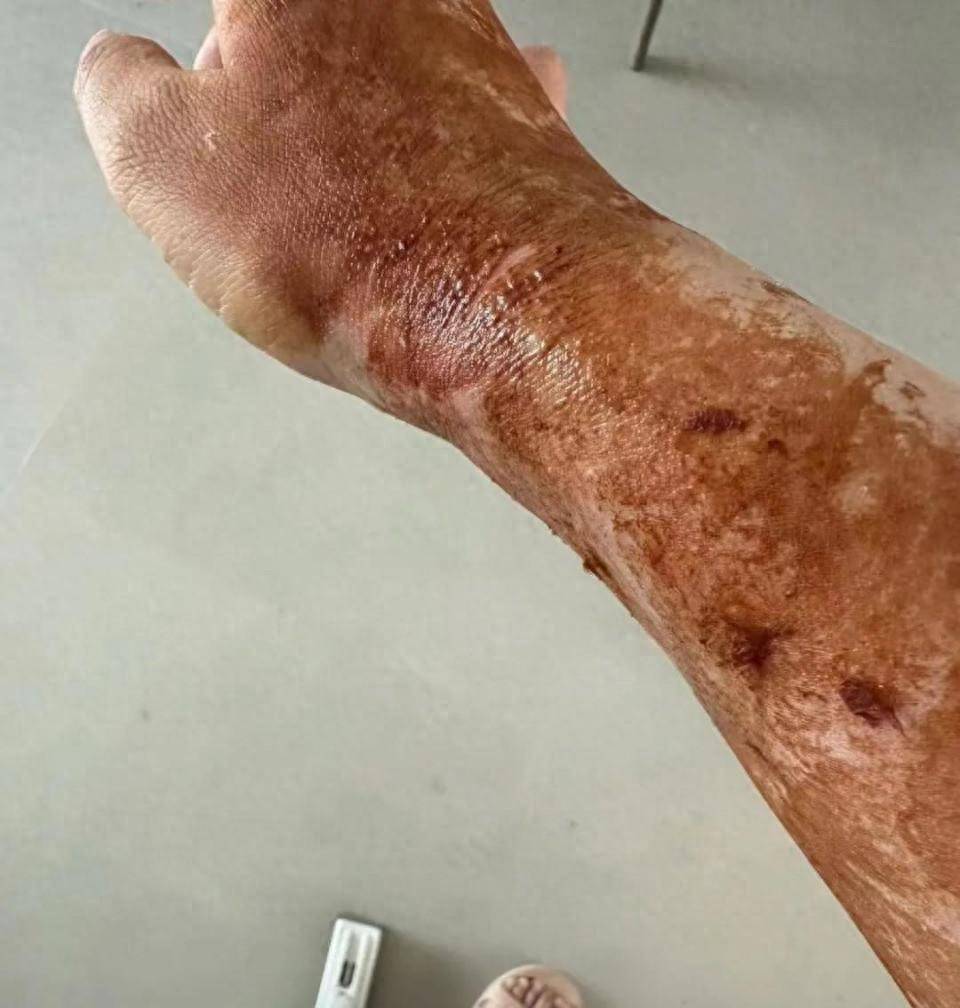 欧洲杯买球_易燃易爆炸的氢气球欧洲杯买球,看完还敢给孩子买它吗?