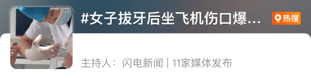 皇冠信用盘庄家
_高空惊魂皇冠信用盘庄家
!女子拔智齿后坐飞机嘴里突然开始冒鲜血……医生紧急提醒