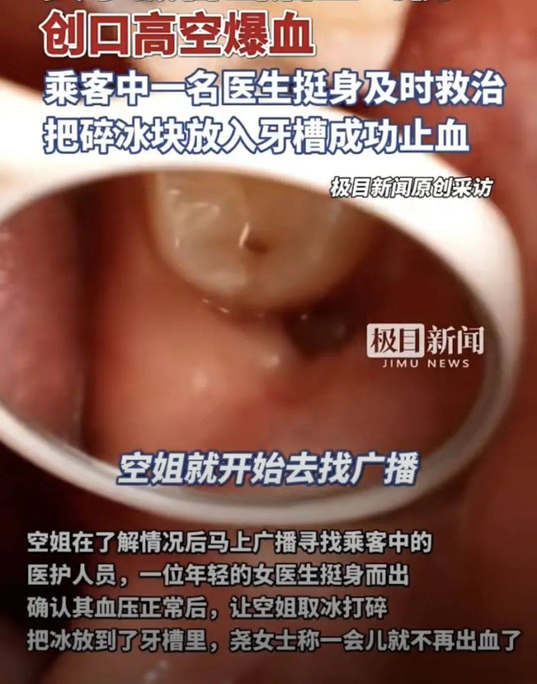 皇冠信用盘庄家
_高空惊魂皇冠信用盘庄家
!女子拔智齿后坐飞机嘴里突然开始冒鲜血……医生紧急提醒