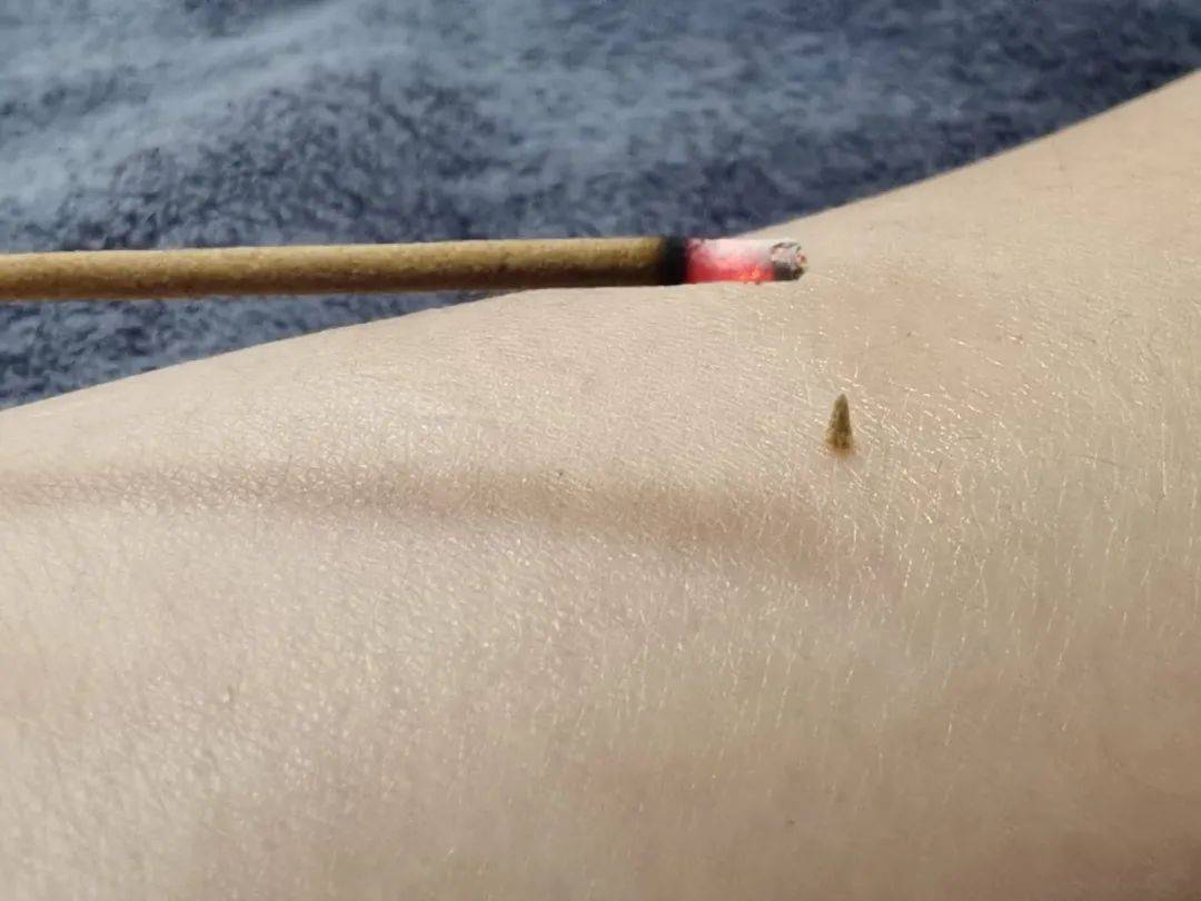 皇冠信用網代理出租
_醒来“天塌了”皇冠信用網代理出租
!深圳一女子眼睛闭不上、嘴巴漏水!这些错误很多人会犯