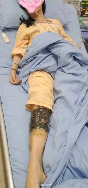 皇冠信用網会员开户
_女子在云南被银环蛇咬伤打了十多支血清皇冠信用網会员开户
,自称2年后仍有后遗症:头晕脸麻,没想到恢复得这么慢