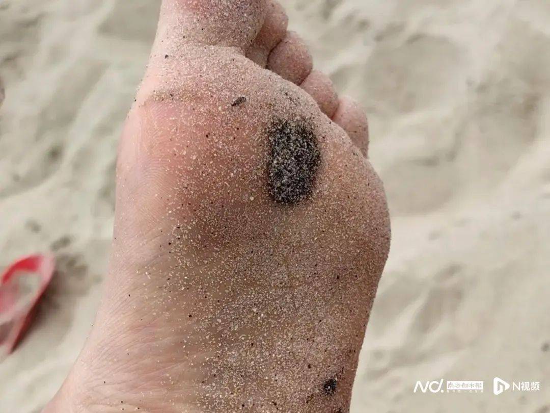 皇冠登3管理出租
_“擦都擦不掉”!多名网友反映深圳大梅沙现黑色油污皇冠登3管理出租
,味道刺鼻!官方回应