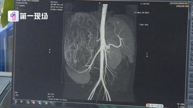 皇冠信用網在线申请
_17岁女孩确诊癌症皇冠信用網在线申请
!买衣服时店员看出端倪……这个细节很重要!