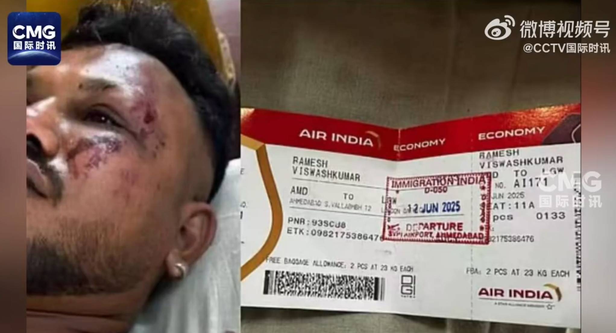 皇冠信用网正网
_印度坠机事故致超290人死亡!警方发现一名坠机幸存者:手持登机牌能行走皇冠信用网正网
,座位是11A!英国首相发声