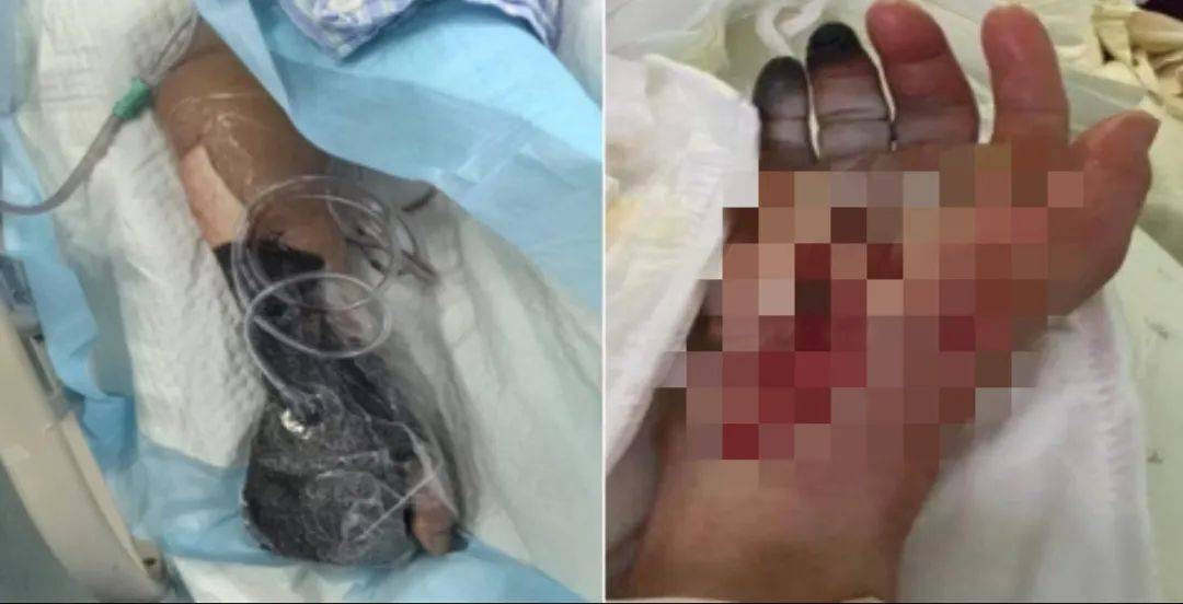 皇冠会员如何申请
_戴手套!戴手套!死亡率近100%皇冠会员如何申请
,浙江已有人中招