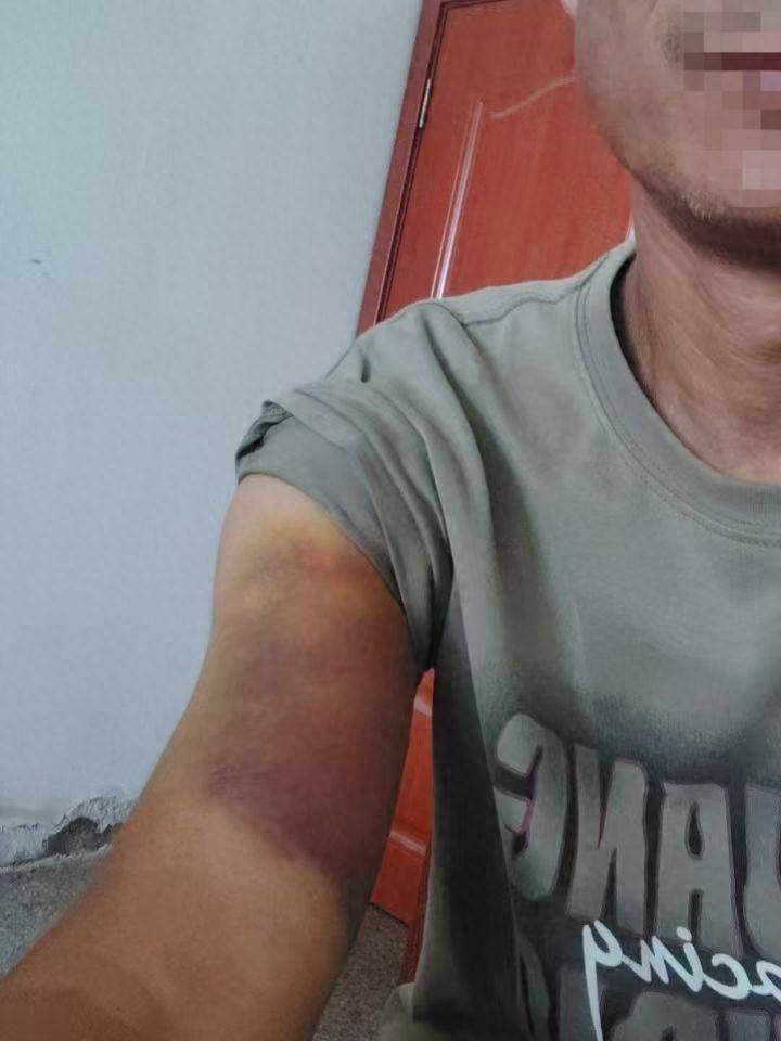 皇冠信用网怎么弄
_河南一男子称因发视频反映村干部家占道遭殴打 多方回应