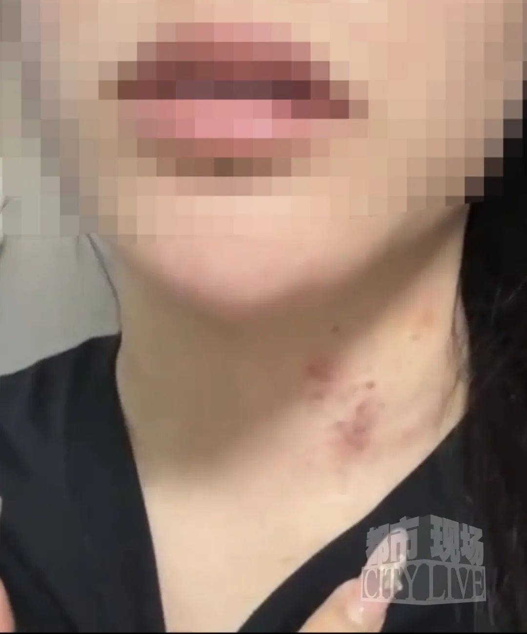 皇冠信用網最高占成
_湖南衡阳29岁女子疑被男友施暴后从25楼跳下身亡 男友徐某此前还刺激说:“你放心皇冠信用網最高占成
,她不会去死的”