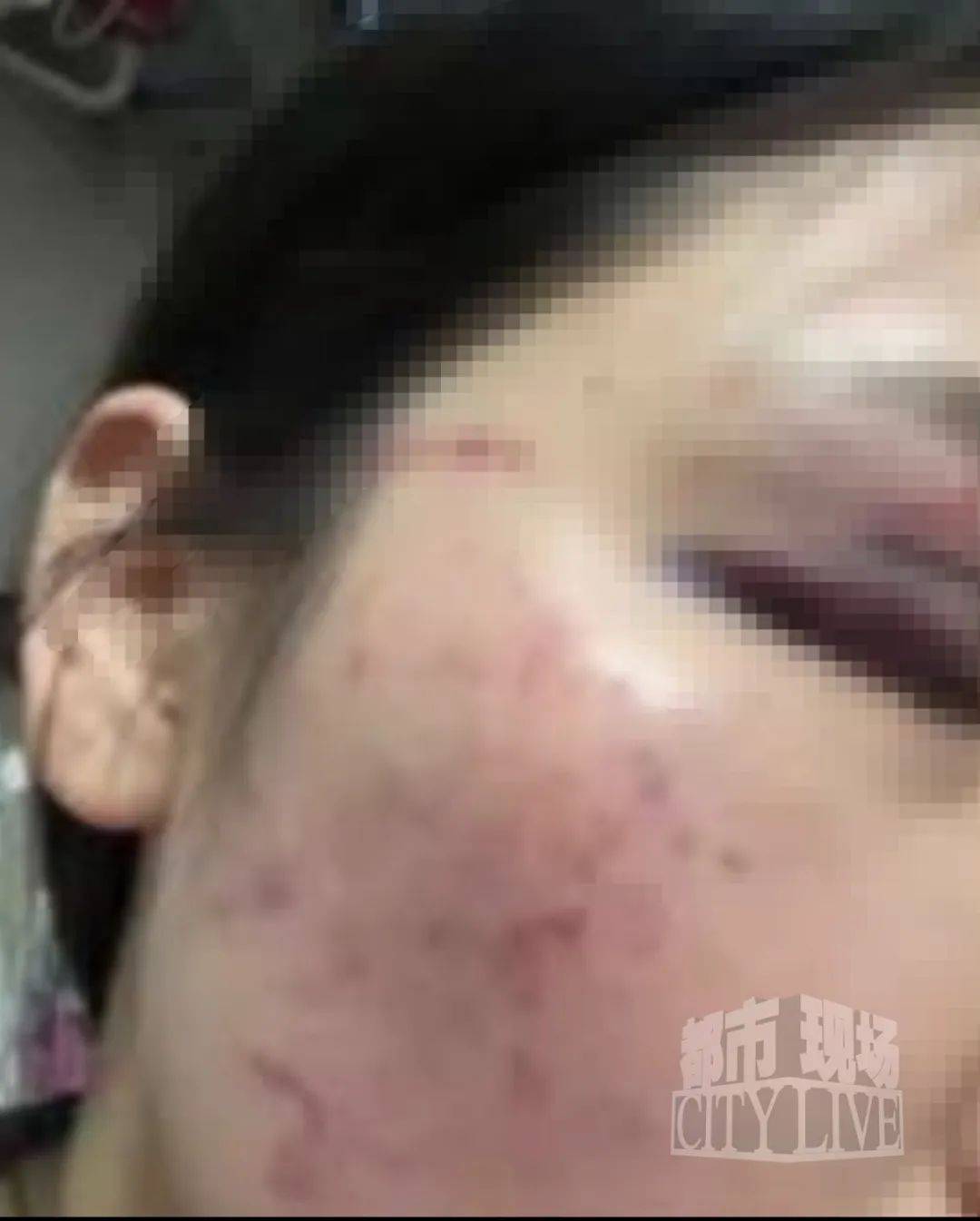 皇冠信用網最高占成
_湖南衡阳29岁女子疑被男友施暴后从25楼跳下身亡 男友徐某此前还刺激说:“你放心皇冠信用網最高占成
,她不会去死的”