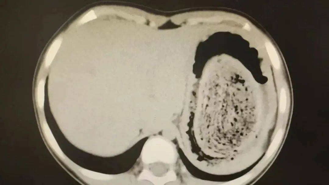 皇冠登3管理出租
_发现1例皇冠登3管理出租
,15岁女孩确诊!